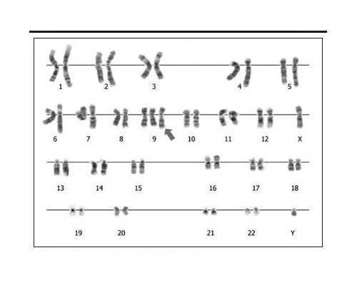 <b>从两个囊胚移植双胞胎的概率是多少?,医院代生费用</b>