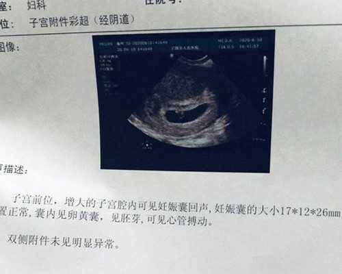 美国试管婴儿卵子捐赠的小贴士,代怀产子价格