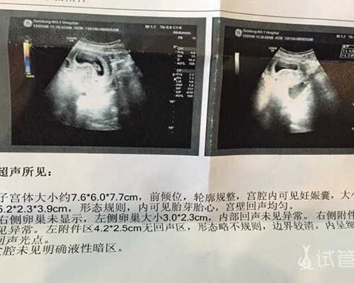 武汉生殖中心做供卵的吗,武汉协和医院生殖医学中心