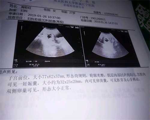  武汉代孕女联系电话_【让爱延续】_什么是胎儿性别试纸