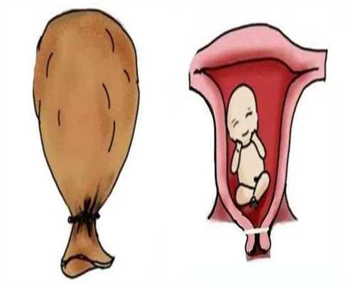 武汉代孕哪家做的好_武汉去代孕费用多少_泰东方国际医疗：有助于疏通输卵管