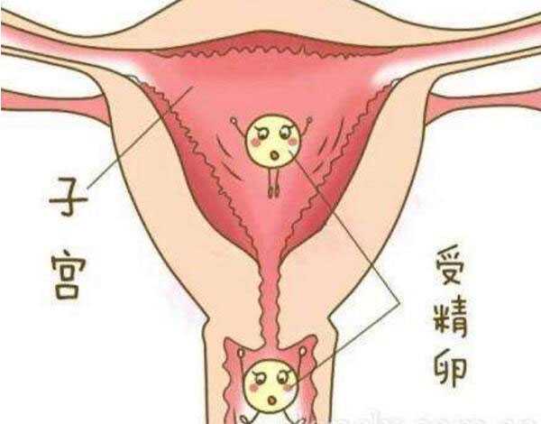 供卵试管被骗钱_包成功双胞胎_泰国试管婴儿可以科学避免生化妊娠吗?